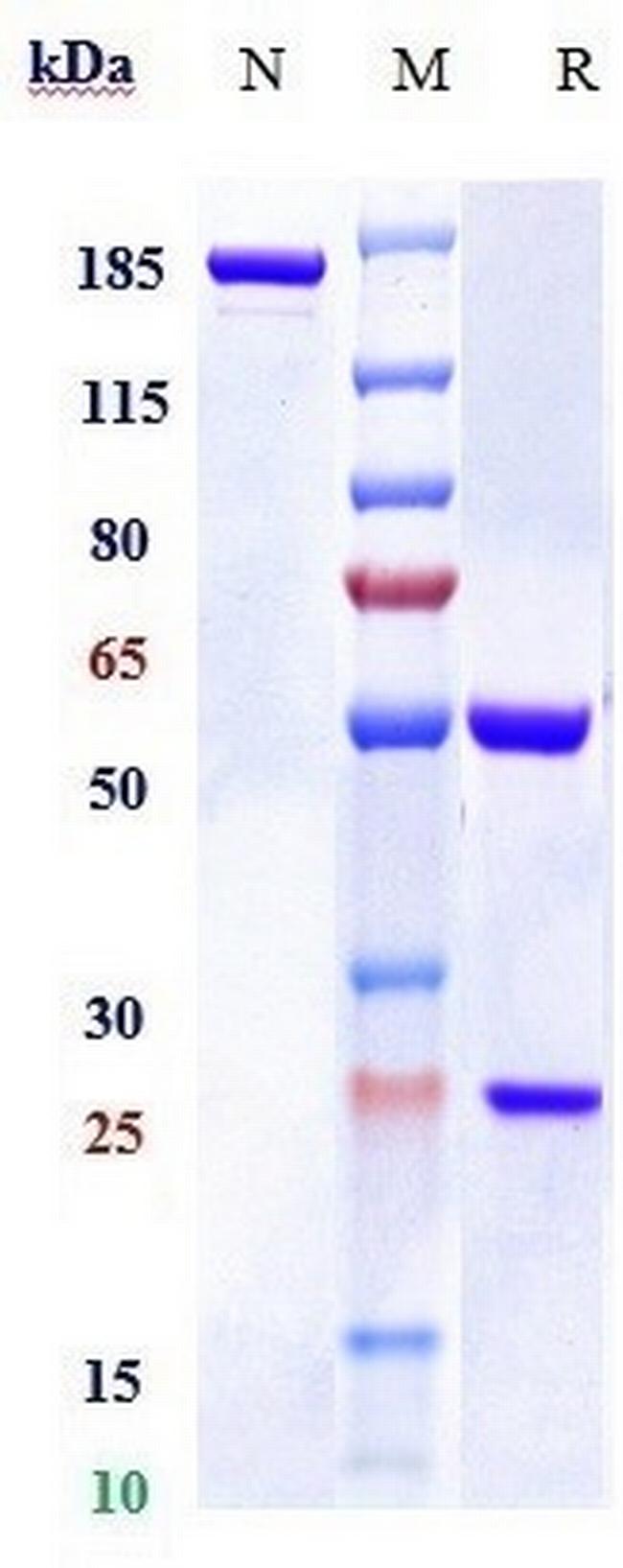 RSPO1 Biosimilar Antibody in SDS-PAGE (SDS-PAGE)
