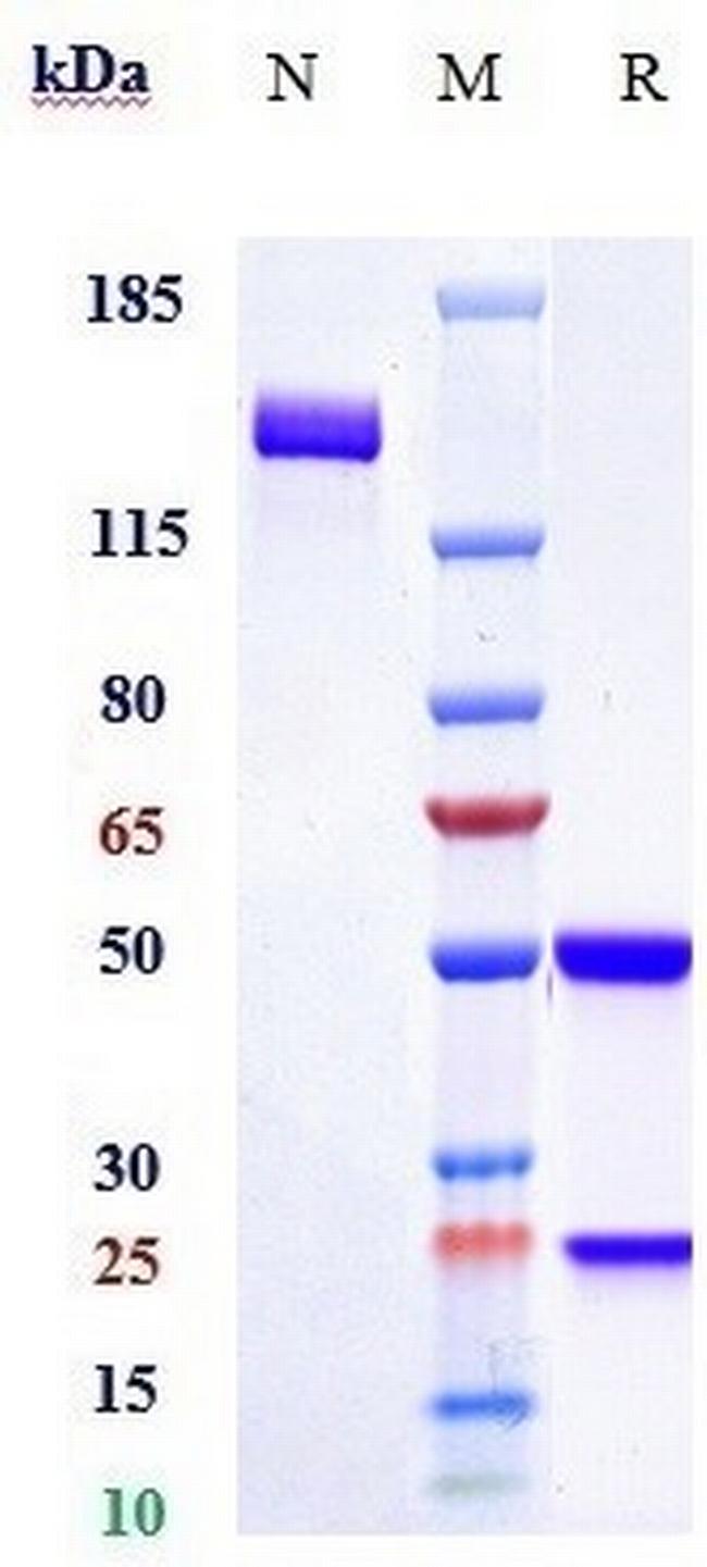 Sclerostin (Romosozumab Biosimilar) Antibody in SDS-PAGE (SDS-PAGE)