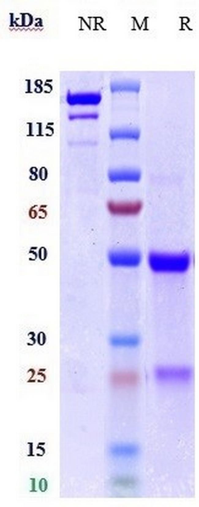 TYRO3 (Biosimilar) Antibody in SDS-PAGE (SDS-PAGE)