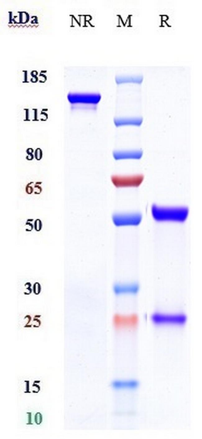 AOC3 (Timolumab Biosimilar) Antibody in SDS-PAGE (SDS-PAGE)