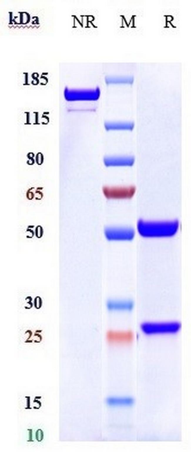 CD6 (Itolizumab Biosimilar) Antibody in SDS-PAGE (SDS-PAGE)