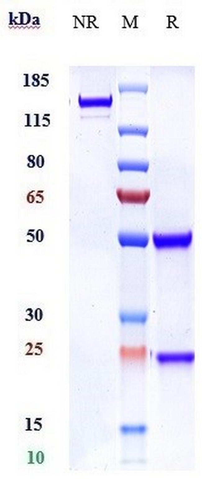 ROBO1 Chimeric Biosimilar Antibody in SDS-PAGE (SDS-PAGE)