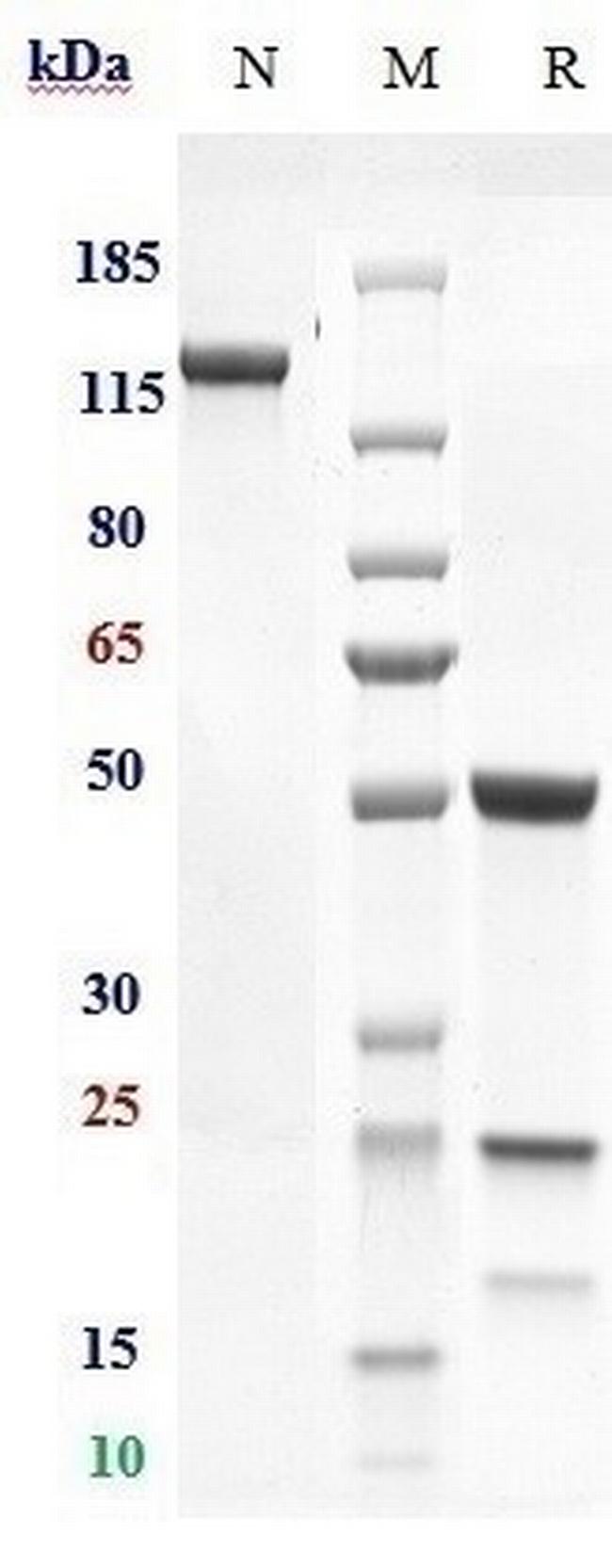AMHR2 (Murlentamab Biosimilar) Antibody in SDS-PAGE (SDS-PAGE)