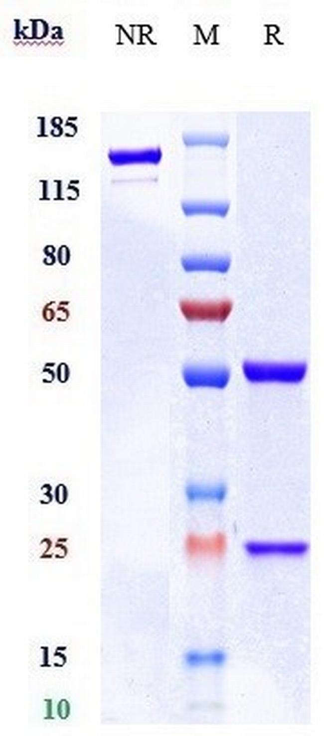 CD105 (Endoglin) (Carotuximab Biosimilar) Antibody in SDS-PAGE (SDS-PAGE)