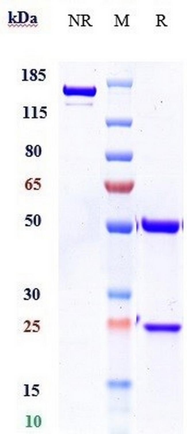 Burosumab Antibody in SDS-PAGE (SDS-PAGE)
