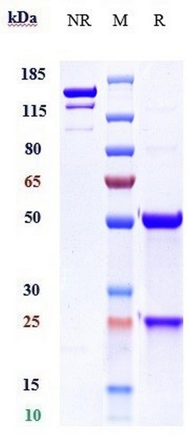 IL-22 Receptor alpha (Temtokibart Biosimilar) Antibody in SDS-PAGE (SDS-PAGE)