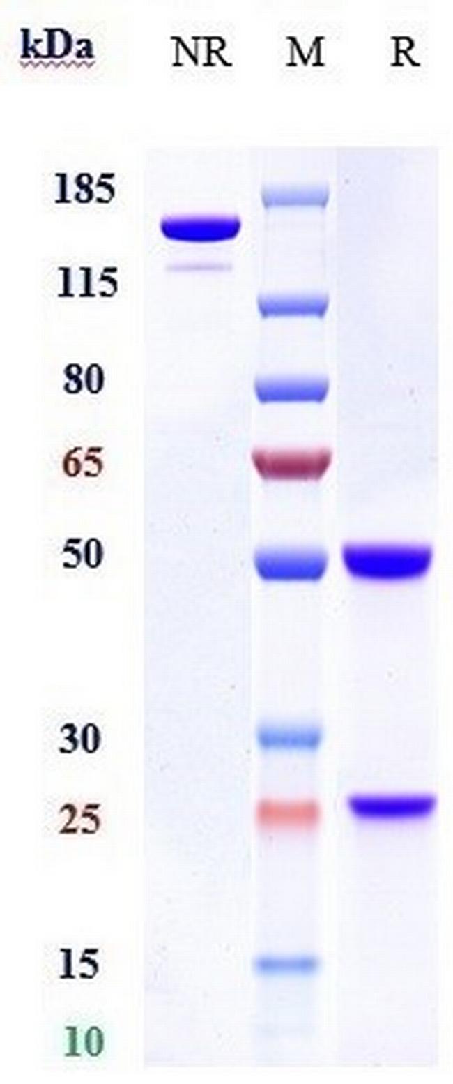 Complement C3 (Biosimilar) Antibody in SDS-PAGE (SDS-PAGE)