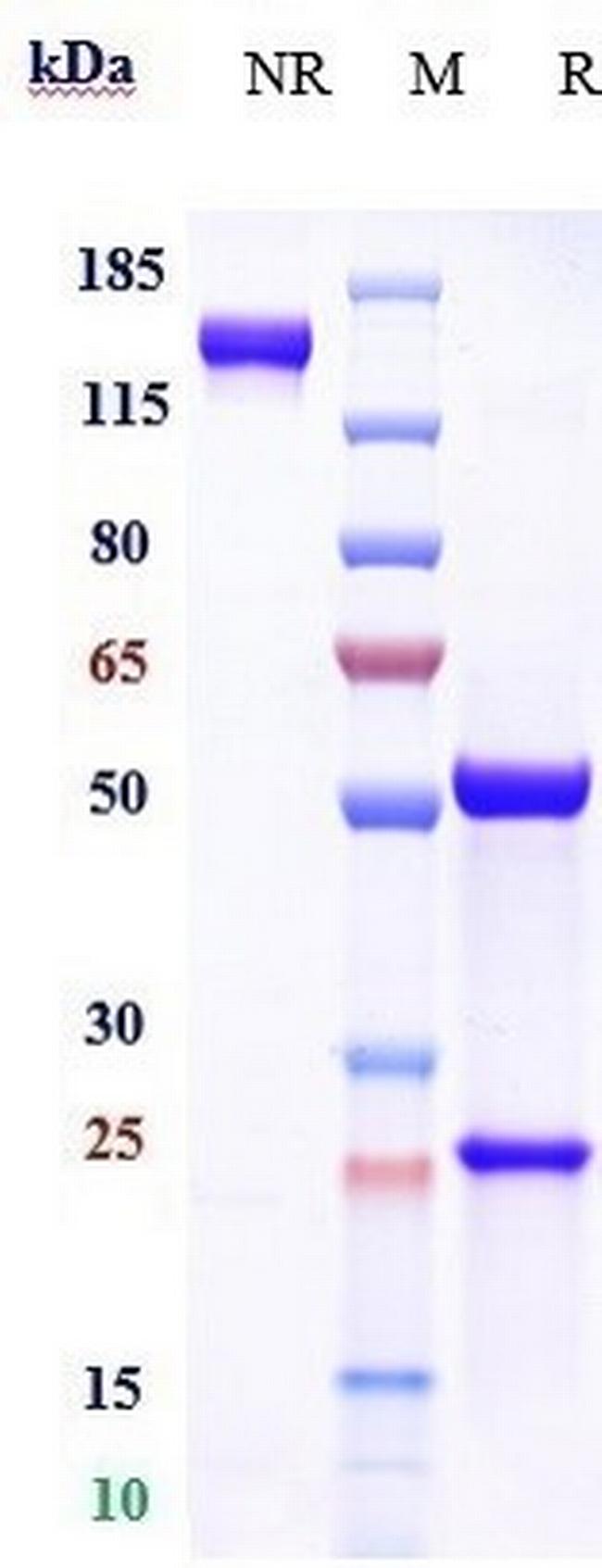 Sotevtamab Antibody in SDS-PAGE (SDS-PAGE)