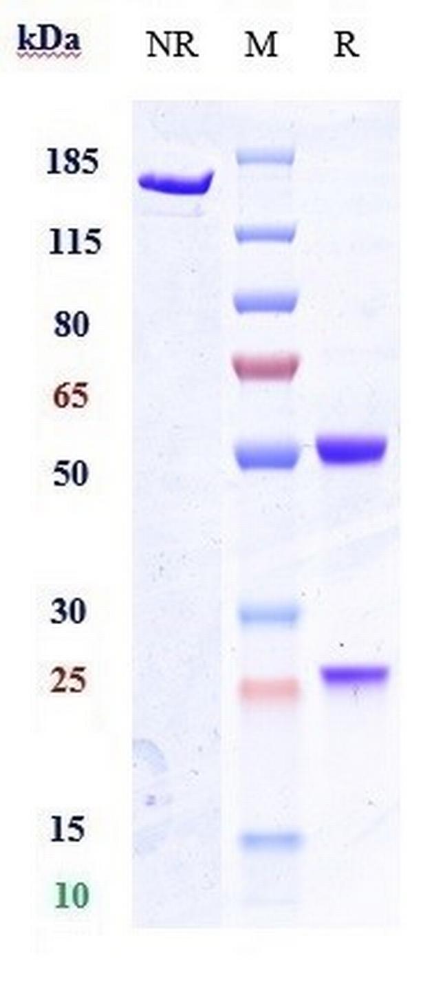 Anumigilimab Antibody in SDS-PAGE (SDS-PAGE)