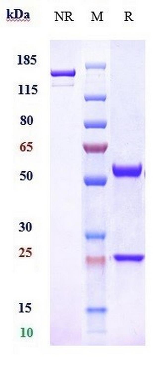 Adrenomedullin (Enibarcimab Biosimilar) Antibody in SDS-PAGE (SDS-PAGE)