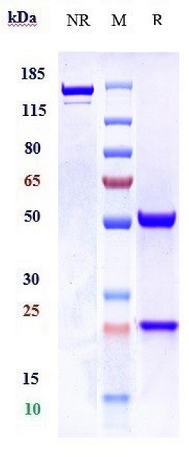 PCYT1B Biosimilar Antibody in SDS-PAGE (SDS-PAGE)