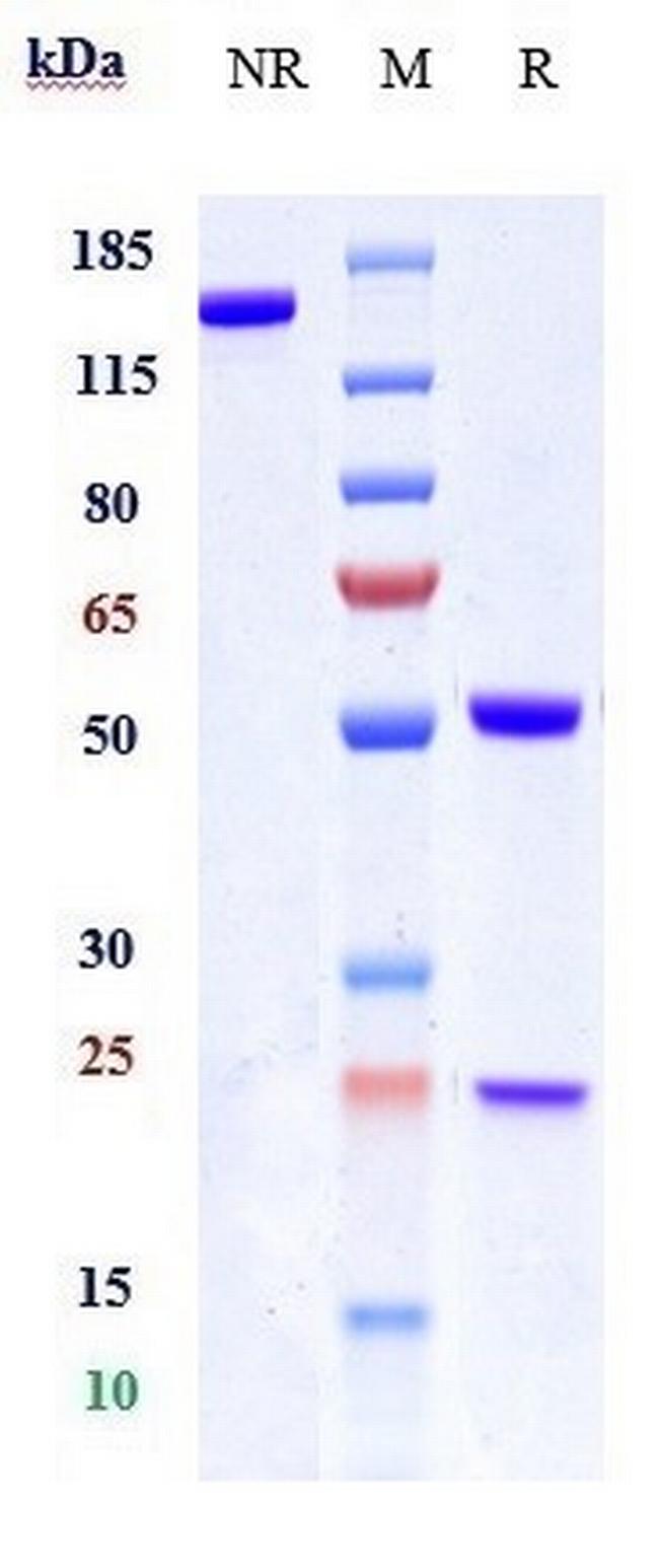 Eblasakimab Antibody in SDS-PAGE (SDS-PAGE)