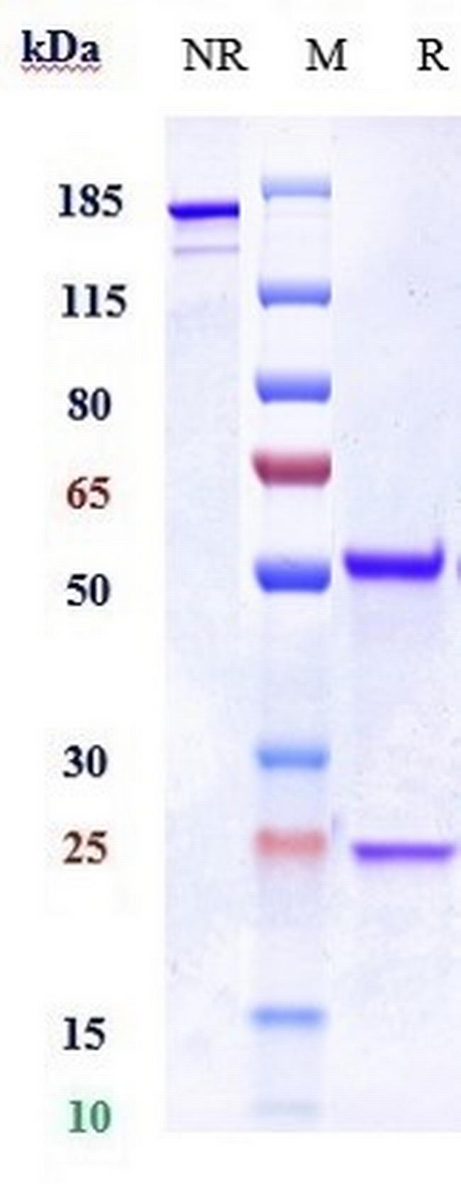 CD18 (Erlizumab Biosimilar) Antibody in SDS-PAGE (SDS-PAGE)