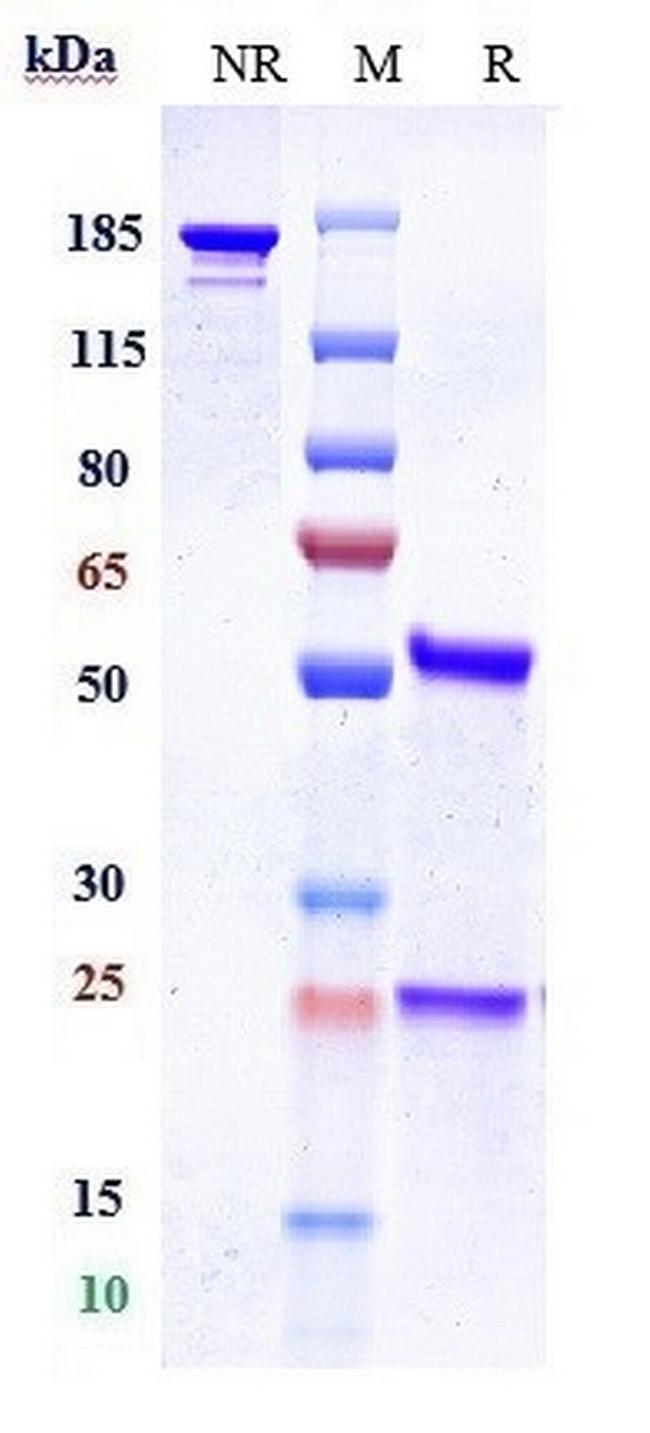 Properdin Humanized Biosimilar Antibody in SDS-PAGE (SDS-PAGE)