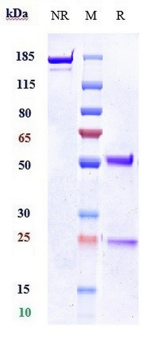 Kallikrein 5 Biosimilar Antibody in SDS-PAGE (SDS-PAGE)