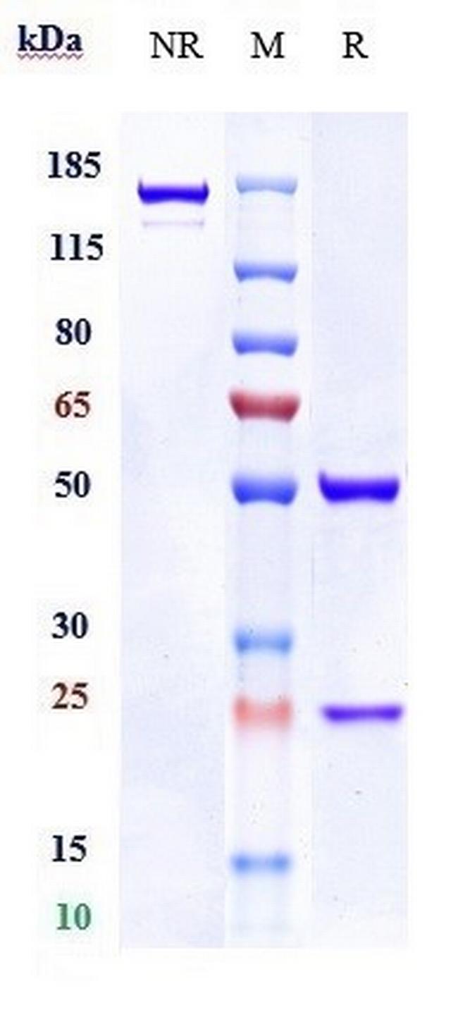 RG1 (Biosimilar) Antibody in SDS-PAGE (SDS-PAGE)