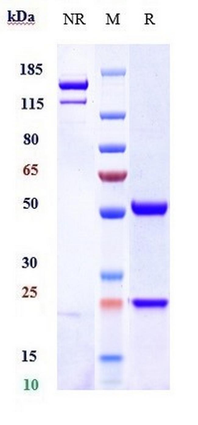 CXC-ELR Biosimilar Antibody in SDS-PAGE (SDS-PAGE)