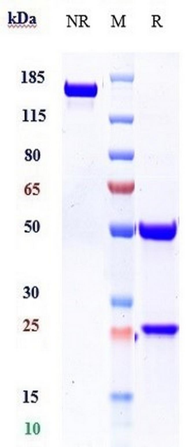 Canakinumab Antibody in SDS-PAGE (SDS-PAGE)