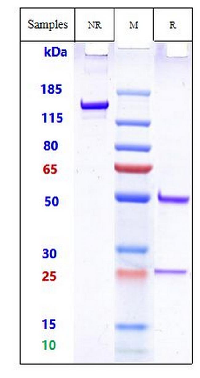 158P1D7 Biosimilar Antibody in SDS-PAGE (SDS-PAGE)