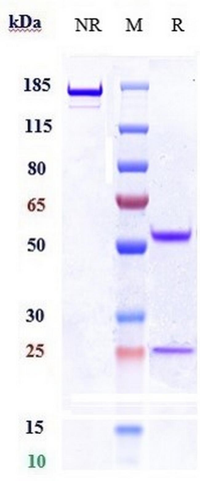 RET Biosimilar Antibody in SDS-PAGE (SDS-PAGE)