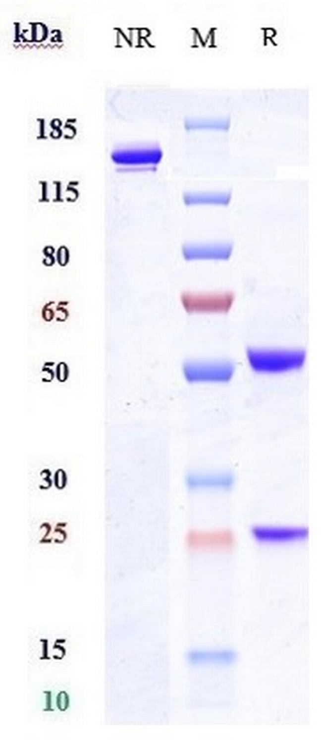 Tamrintamab Antibody in SDS-PAGE (SDS-PAGE)