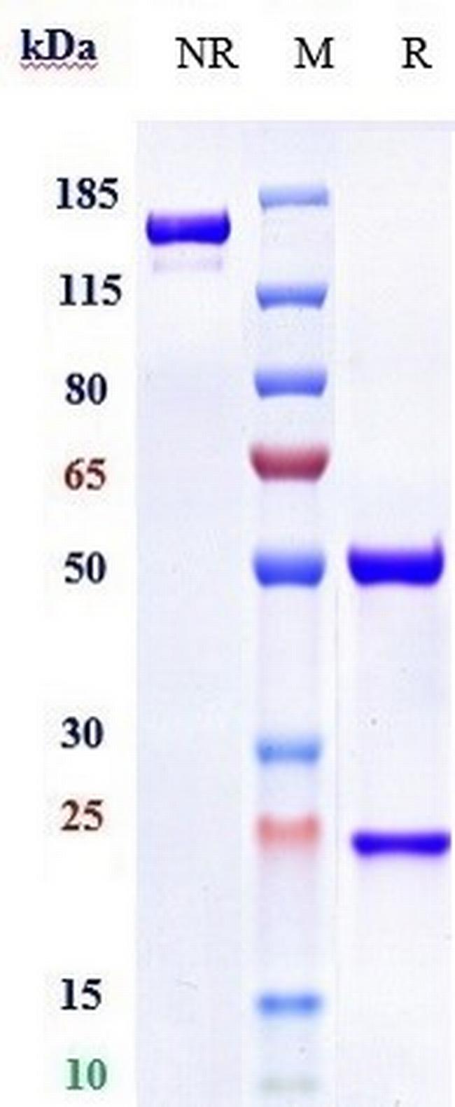 Glypican 1 Humanized Biosimilar Antibody in SDS-PAGE (SDS-PAGE)