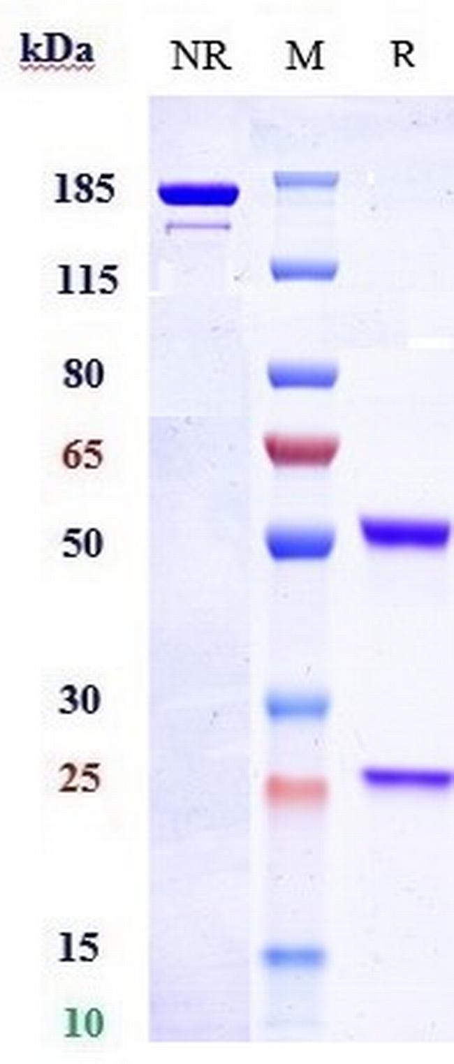 Endothelin B Receptor Biosimilar Antibody in SDS-PAGE (SDS-PAGE)