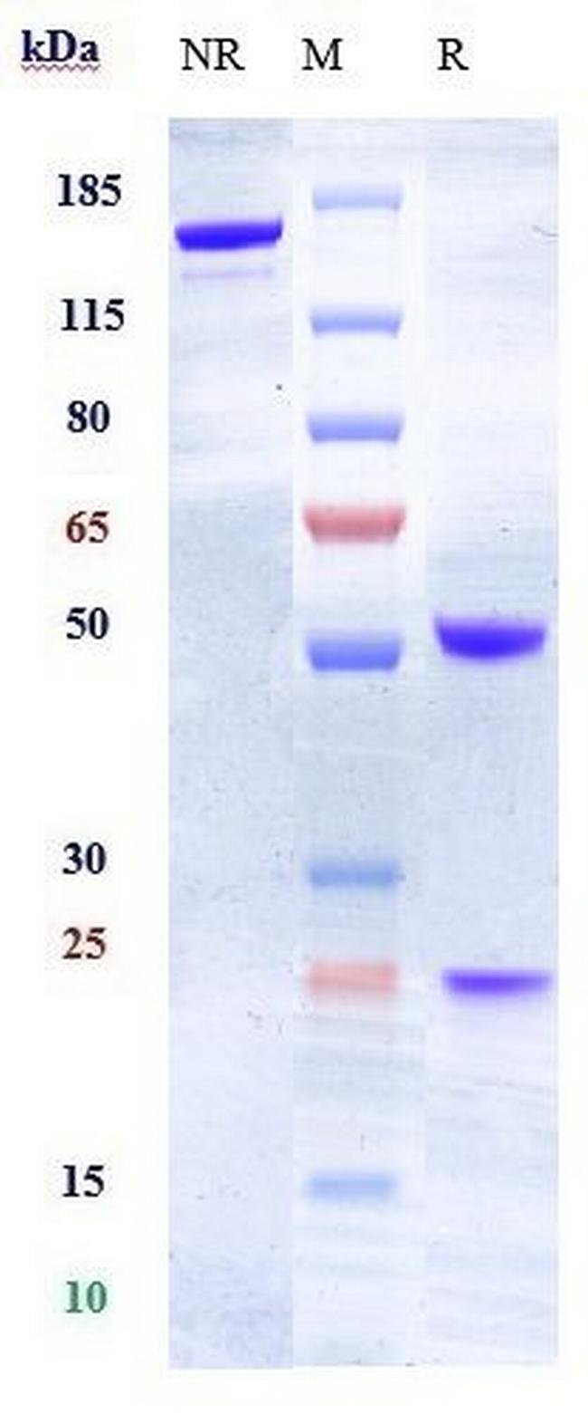 Ephrin A4 Biosimilar Antibody in SDS-PAGE (SDS-PAGE)