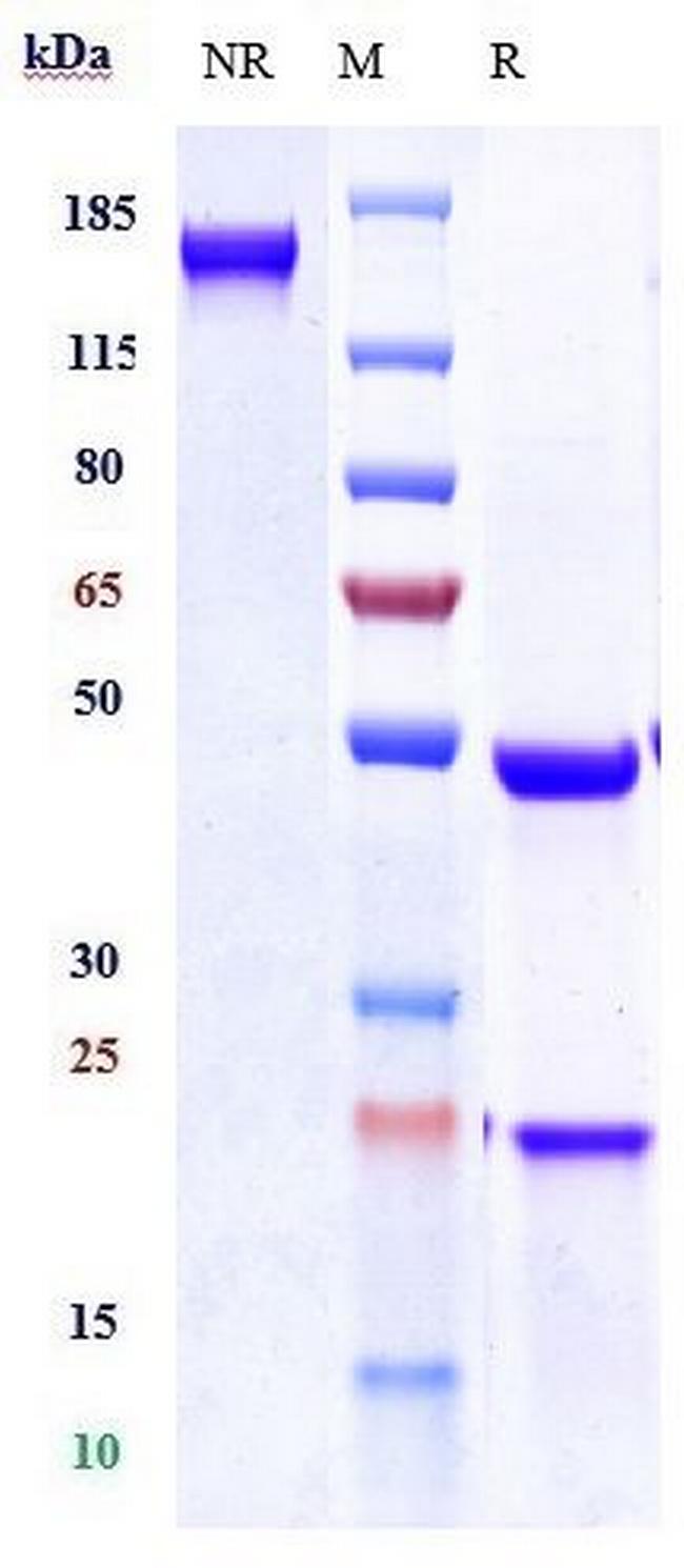 Tarextumab Antibody in SDS-PAGE (SDS-PAGE)