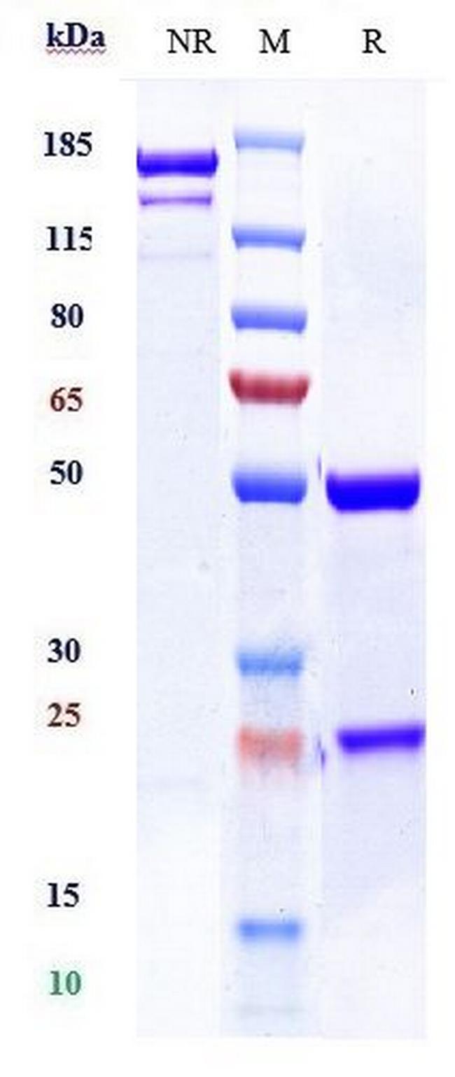 TSH Receptor Biosimilar Antibody in SDS-PAGE (SDS-PAGE)
