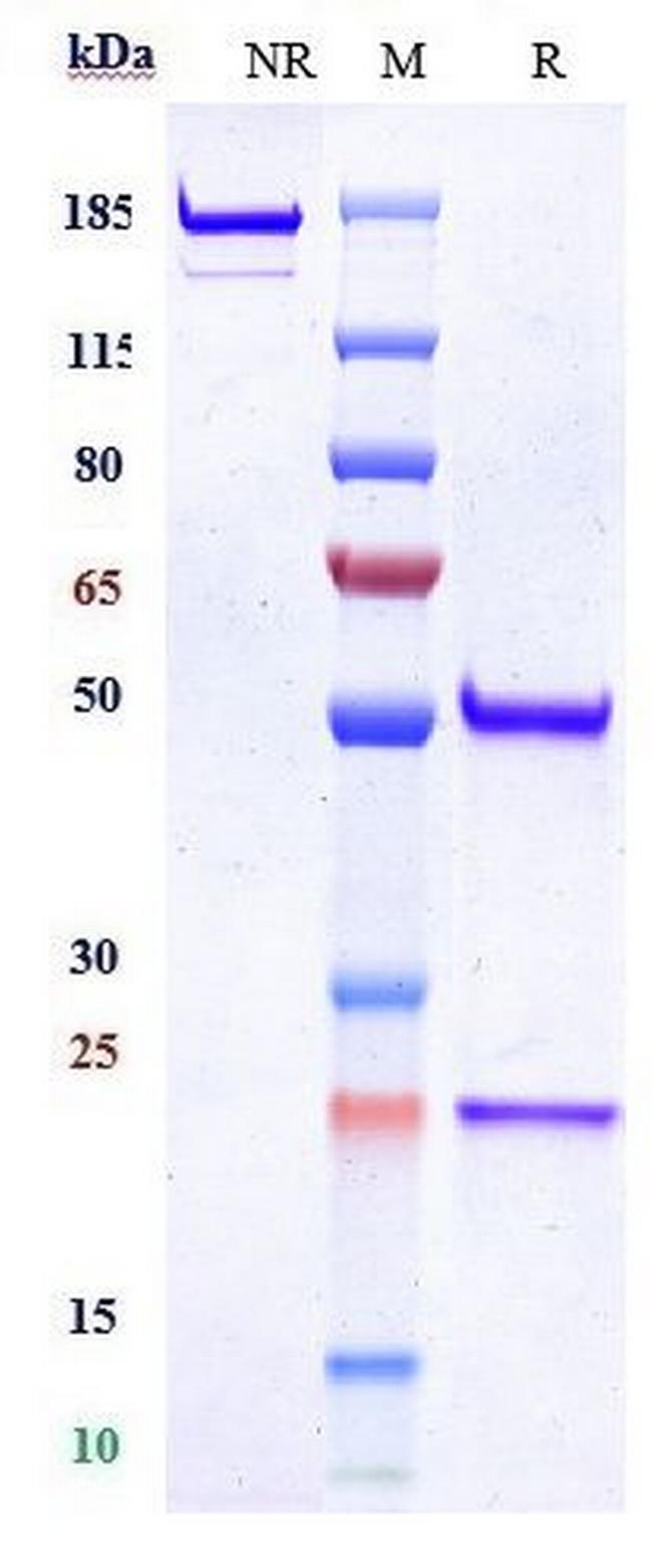 MUSK Biosimilar Antibody in SDS-PAGE (SDS-PAGE)