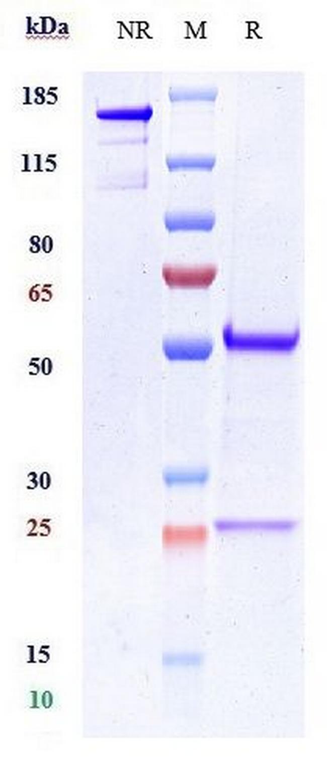 CDH11 Humanized Biosimilar Antibody in SDS-PAGE (SDS-PAGE)