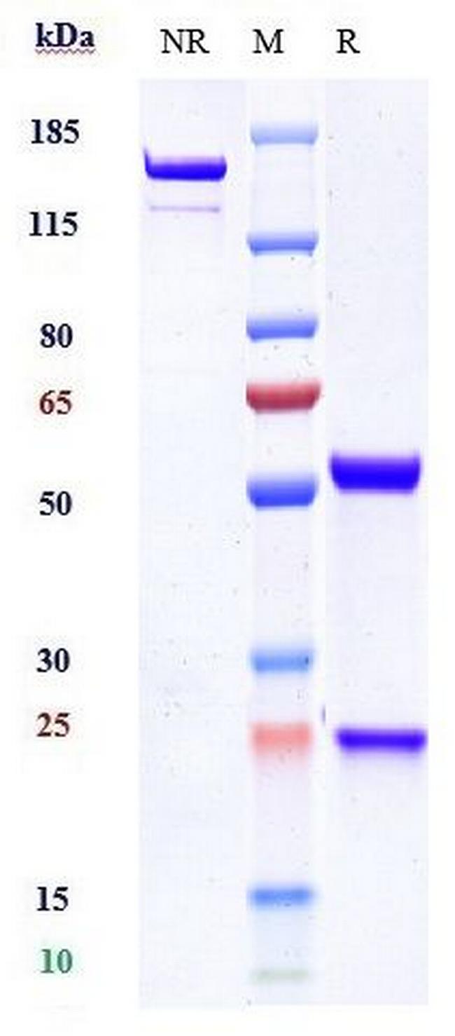 SCN11A Biosimilar Antibody in SDS-PAGE (SDS-PAGE)