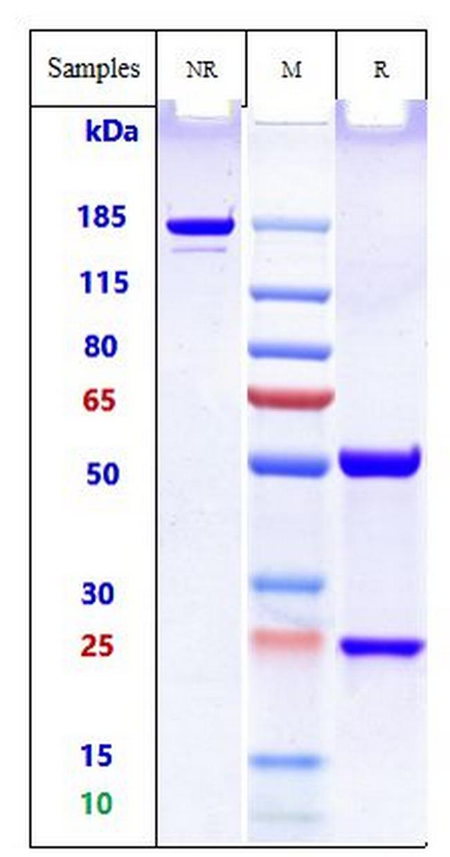 Amyloid Fibrils (Birtamimab Biosimilar) Antibody in SDS-PAGE (SDS-PAGE)