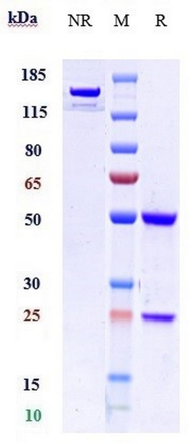 VEGF Receptor 1 Biosimilar Antibody in SDS-PAGE (SDS-PAGE)