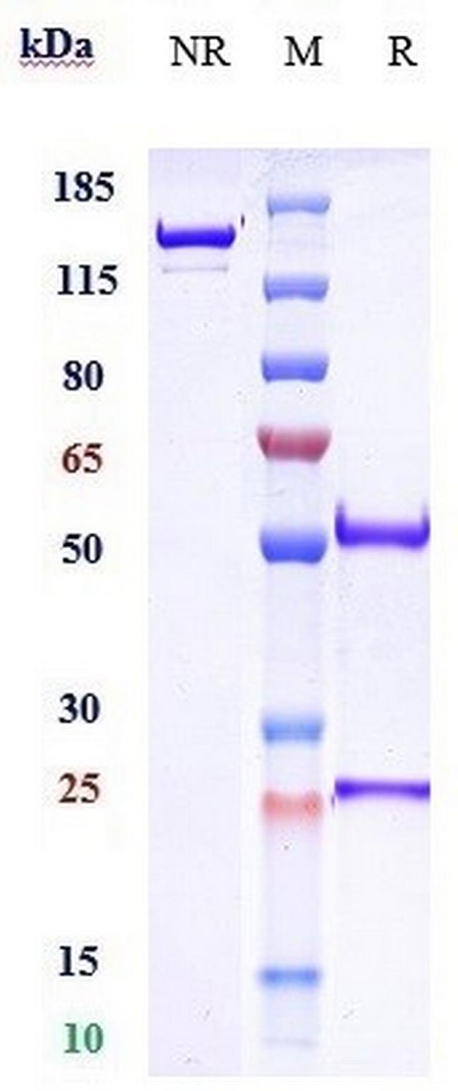 beta Amyloid (Crenezumab Biosimilar) Antibody in SDS-PAGE (SDS-PAGE)