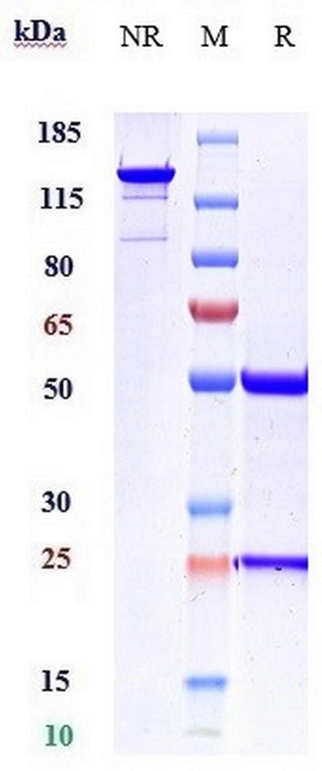 ACVR2B Biosimilar Antibody in SDS-PAGE (SDS-PAGE)