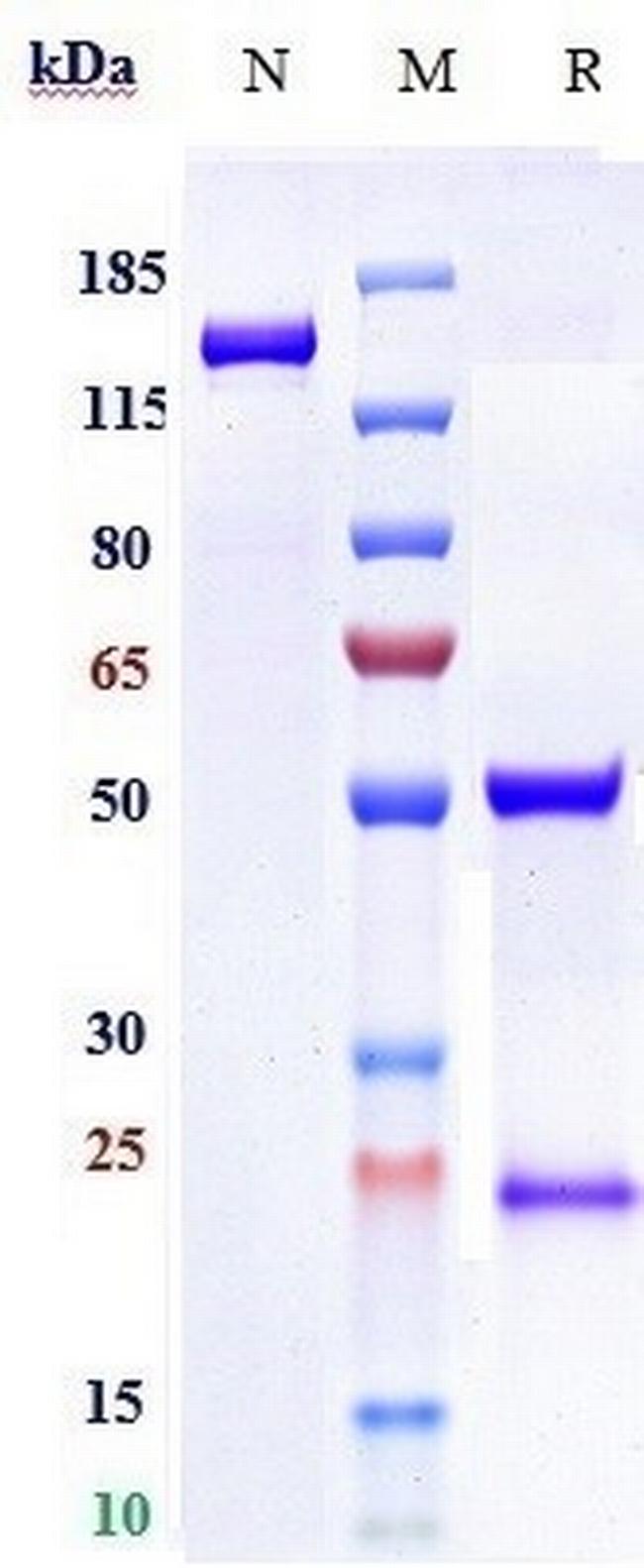 Zansecimab Humanized Antibody in SDS-PAGE (SDS-PAGE)