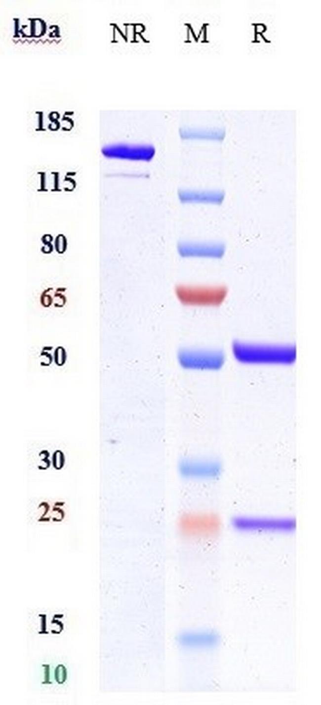 ANGPTL4 Biosimilar Antibody in SDS-PAGE (SDS-PAGE)