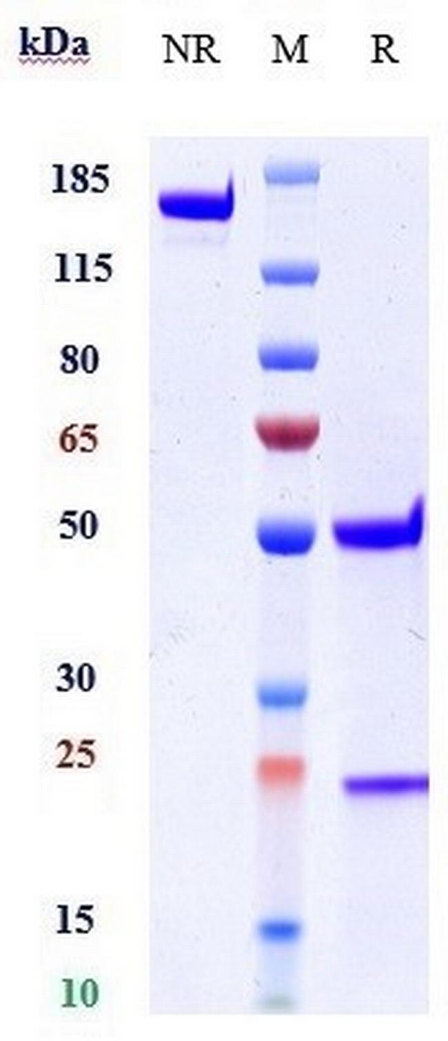 ST2 (Astegolimab Biosimilar) Antibody in SDS-PAGE (SDS-PAGE)