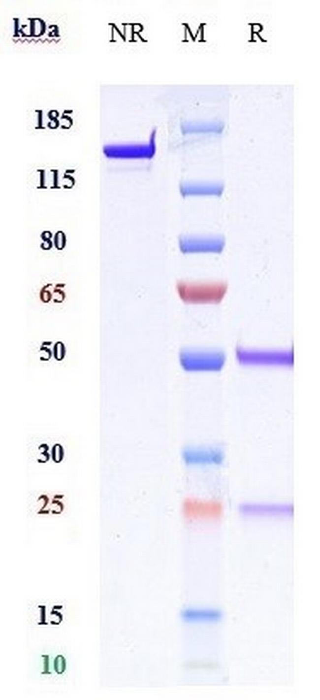 B7-H3 (CD276) Biosimilar Antibody in SDS-PAGE (SDS-PAGE)