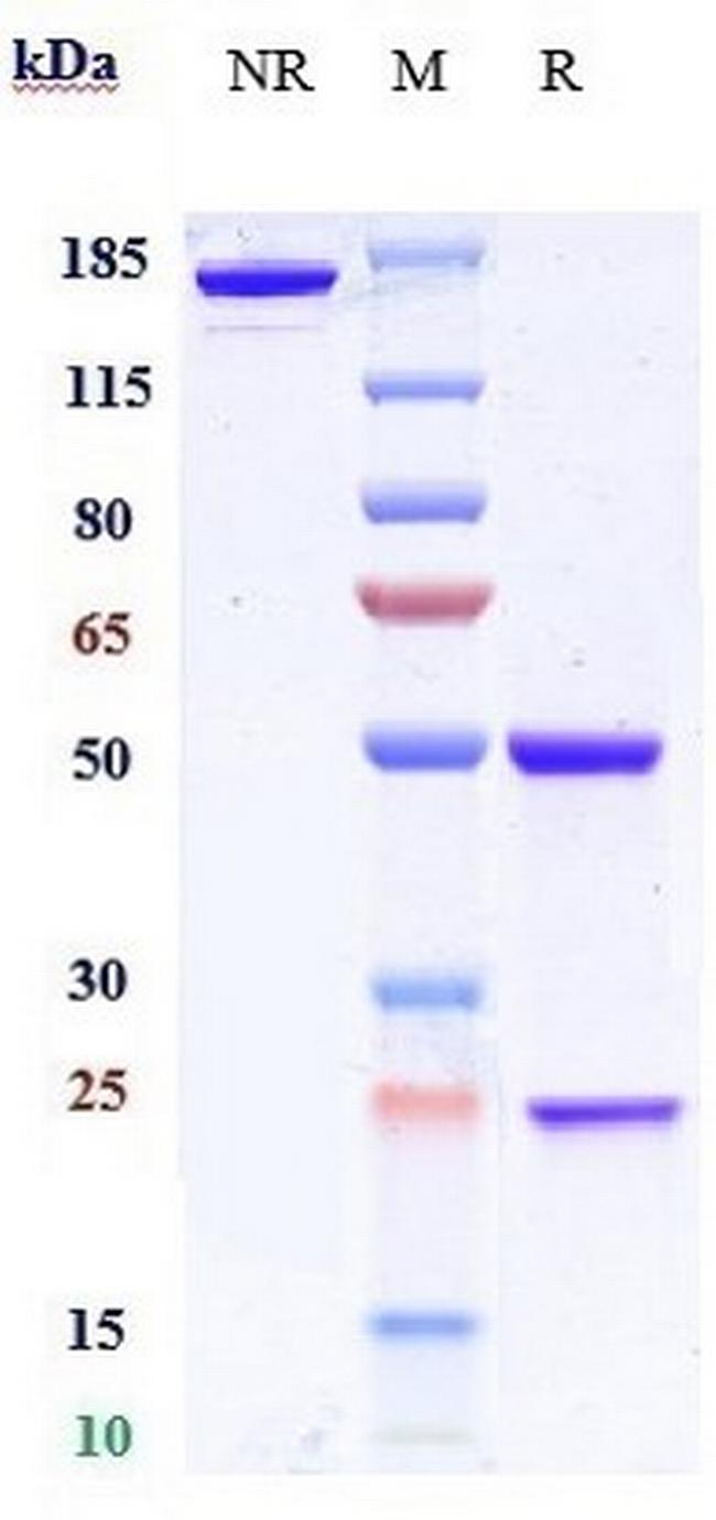 BACE1 Biosimilar Antibody in SDS-PAGE (SDS-PAGE)