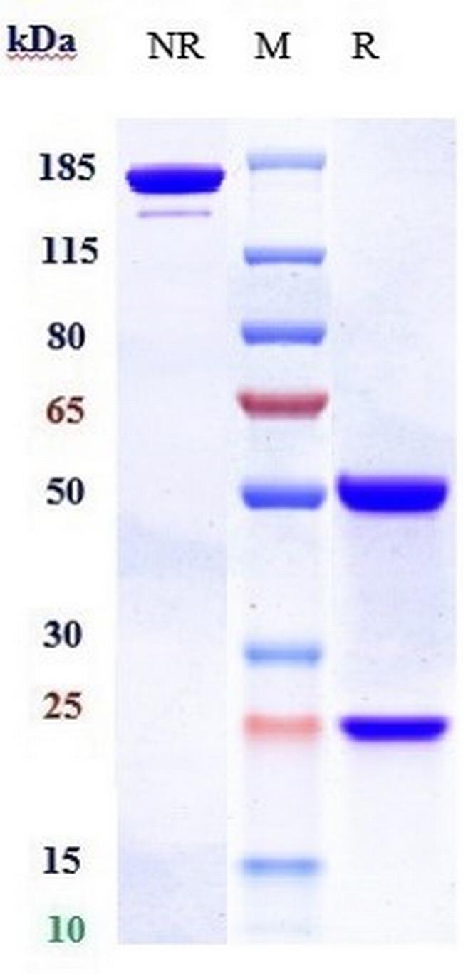 PCSK9 (Bococizumab Biosimilar) Antibody in SDS-PAGE (SDS-PAGE)