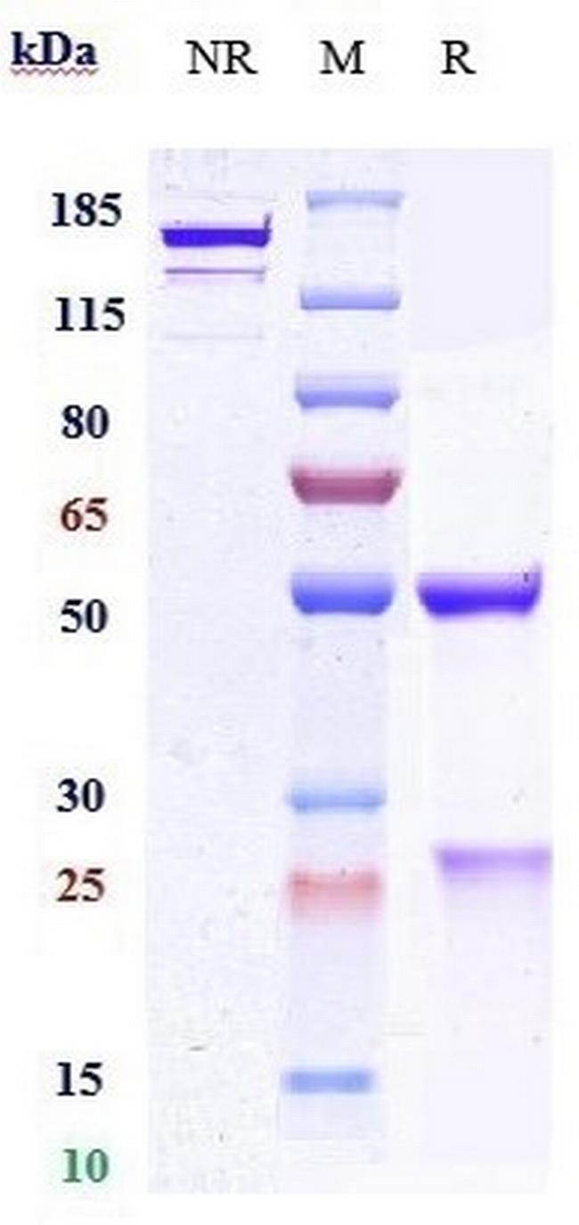 PCSK9 (Biosimilar) Antibody in SDS-PAGE (SDS-PAGE)
