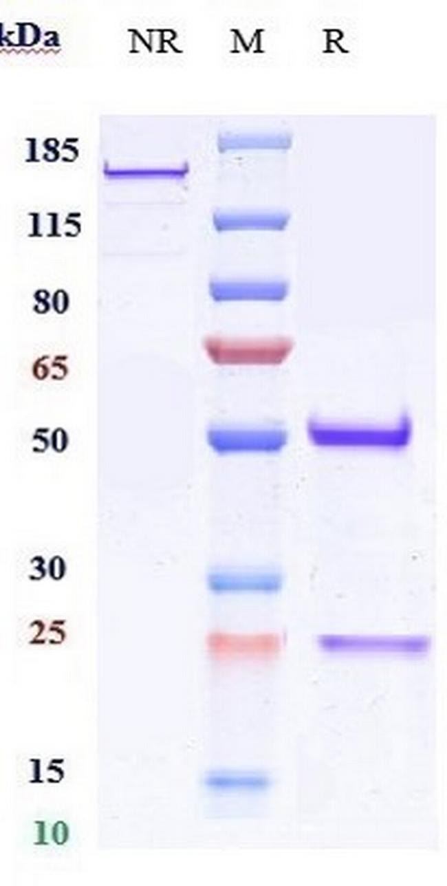 CD151 Biosimilar Antibody in SDS-PAGE (SDS-PAGE)