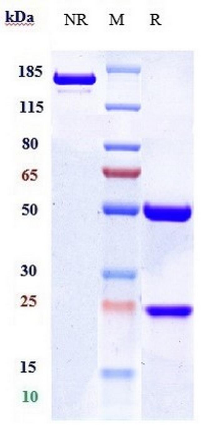 CD19 Biosimilar Antibody in SDS-PAGE (SDS-PAGE)