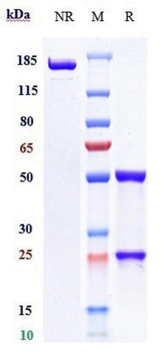 CD19 (Coltuximab Biosimilar) Antibody in SDS-PAGE (SDS-PAGE)