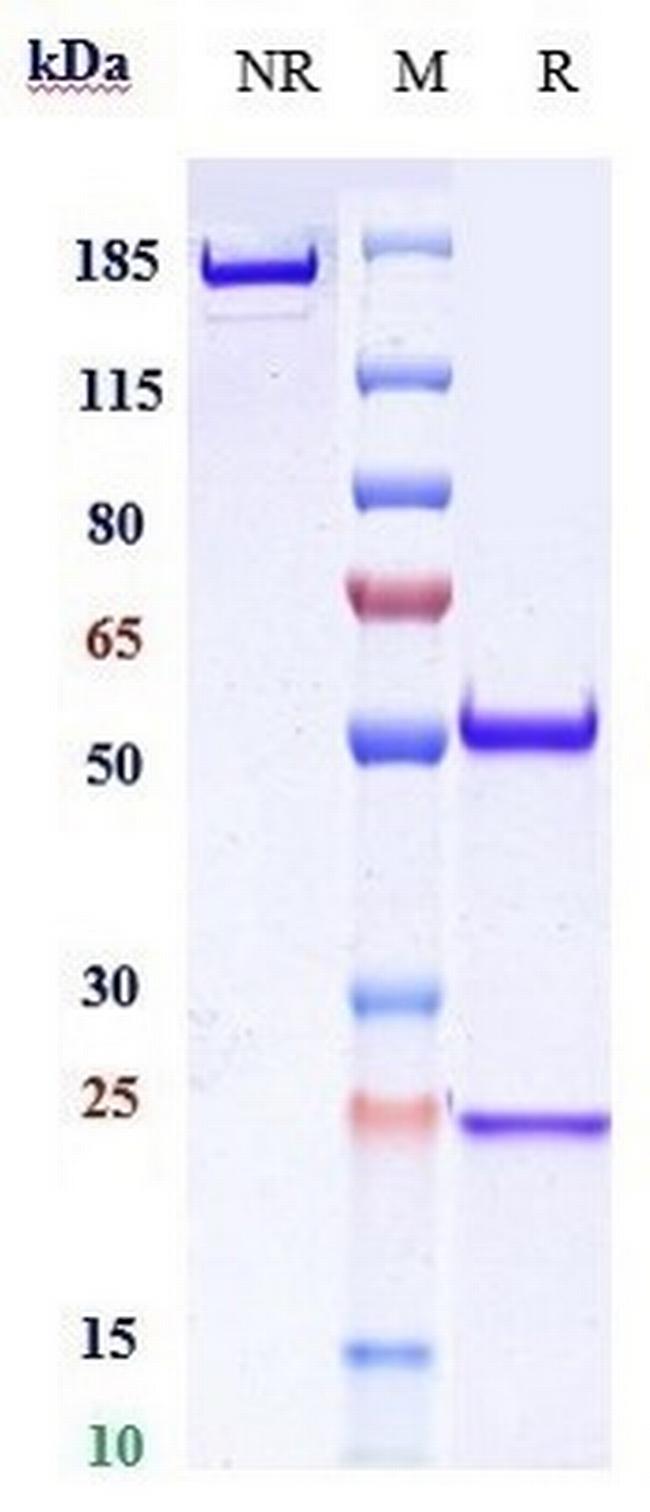 Ripertamab Chimeric Antibody in SDS-PAGE (SDS-PAGE)