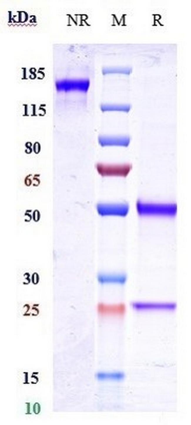 CD20 (Zuberitamab Biosimilar) Antibody in SDS-PAGE (SDS-PAGE)