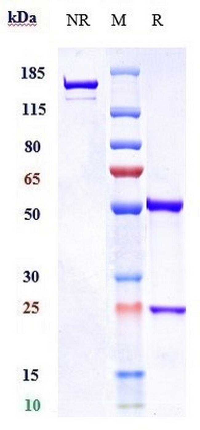 Visilizumab Humanized Antibody in SDS-PAGE (SDS-PAGE)
